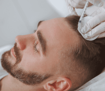 Ankara Saç PRP Tedavisi