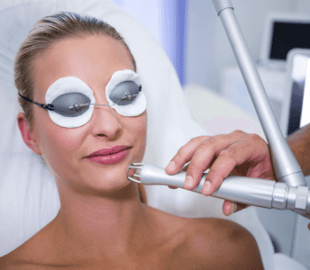 Ankara Q-Switch Lazer