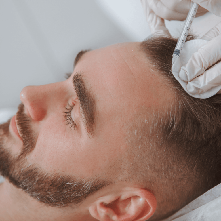 Ankara Saç PRP Tedavisi